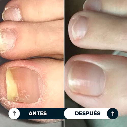 Seralia | Lápiz Antifúngico