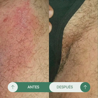 Crema para Rozaduras en Pliegues H - Seralia