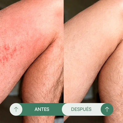 Crema para Rozaduras en Pliegues H - Seralia