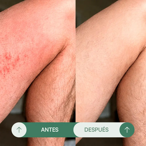 Crema para Rozaduras en Pliegues H - Seralia